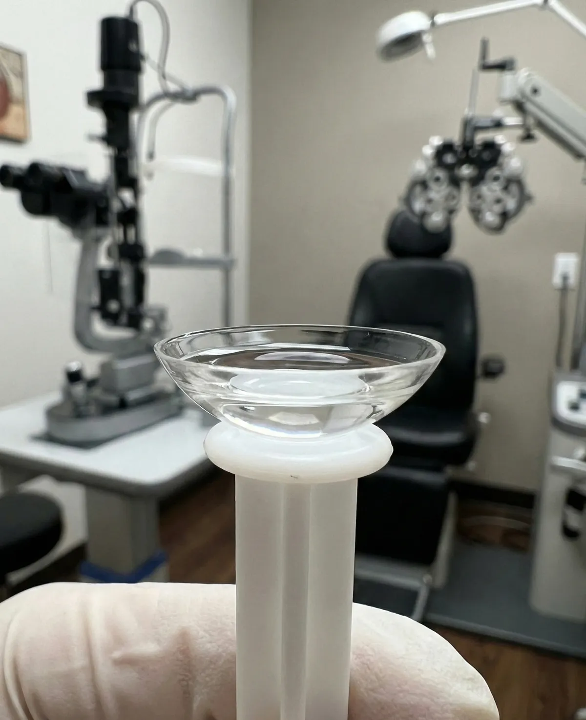 Side profile of a scleral lens fitting at Newton Advanced Eye Services - Dr. Kian Patel